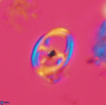 Asynithistostoichos coxalliae 40180