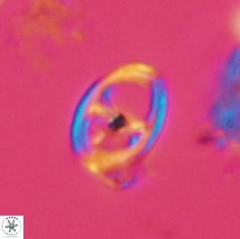 Asynithistostoichos coxalliae 40180