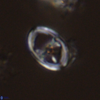 Asynithistostoichos coxalliae 40181