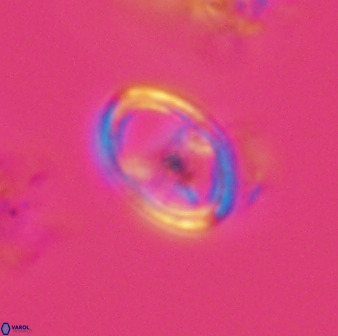 Asynithistostoichos coxalliae 40182