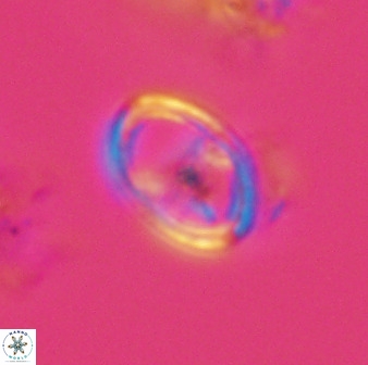 Asynithistostoichos coxalliae 40182