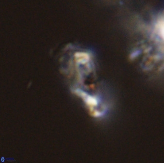 Asynithistostoichos coxalliae 40183