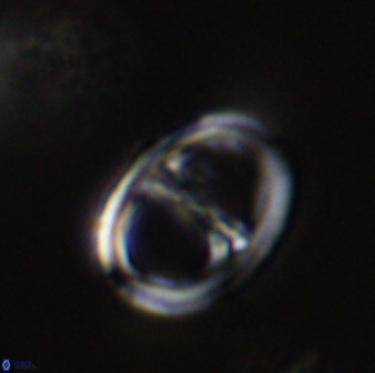 Asynithistostoichos coxalliae 40351