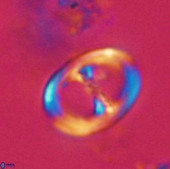 Asynithistostoichos coxalliae 40352