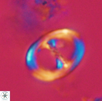 Asynithistostoichos coxalliae 40352