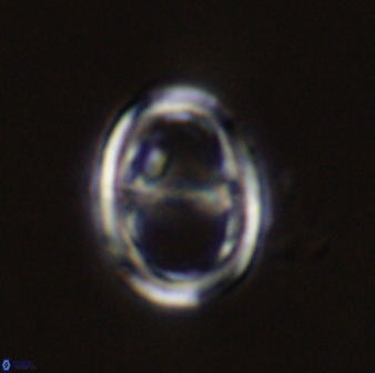 Asynithistostoichos coxalliae 40358