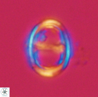 Asynithistostoichos coxalliae 40363