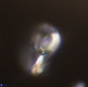 Asynithistostoichos coxalliae 40365