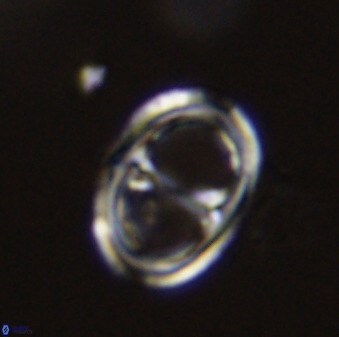 Asynithistostoichos coxalliae 40366