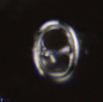 Asynithistostoichos coxalliae 40369