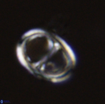 Asynithistostoichos coxalliae 40371