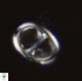 Asynithistostoichos coxalliae 40371