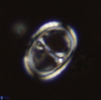 Asynithistostoichos coxalliae 40376