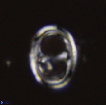 Asynithistostoichos coxalliae 40378