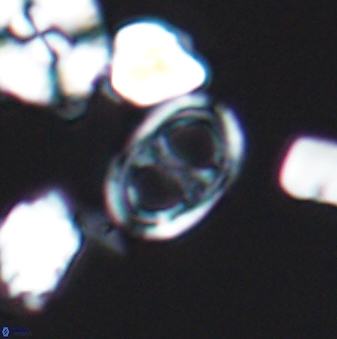 Asynithistostoichos coxalliae 08690