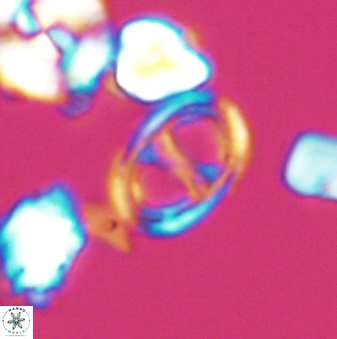 Asynithistostoichos coxalliae 08691