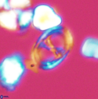 Asynithistostoichos coxalliae 08692