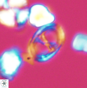 Asynithistostoichos coxalliae 08692