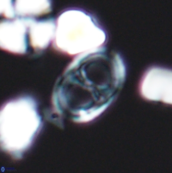 Asynithistostoichos coxalliae 08693