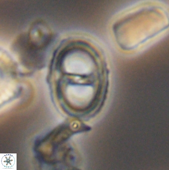 Asynithistostoichos coxalliae 08694