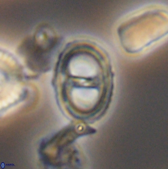 Asynithistostoichos coxalliae 08697