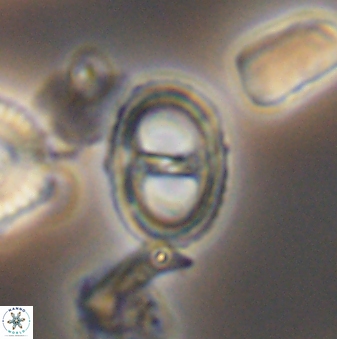 Asynithistostoichos coxalliae 08697