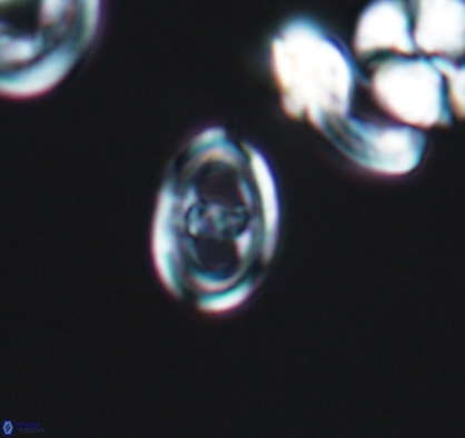Asynithistostoichos coxalliae 10882