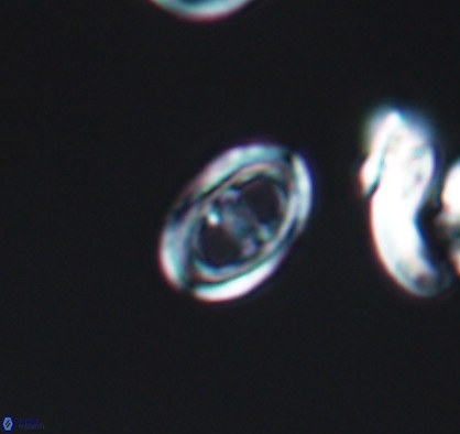Asynithistostoichos coxalliae 10884
