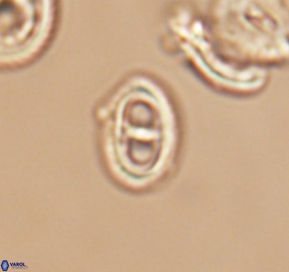 Asynithistostoichos coxalliae 10887