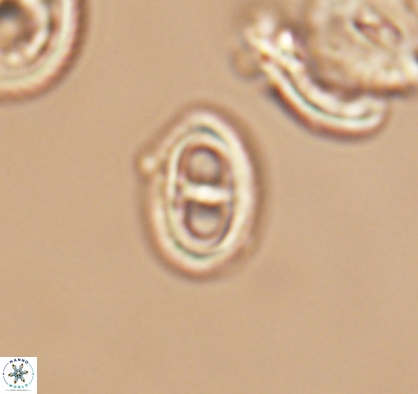 Asynithistostoichos coxalliae 10887