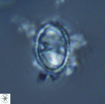 Asynithistostoichos coxalliae 17073