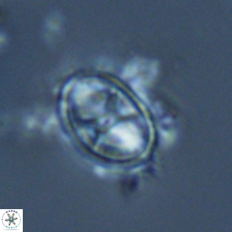 Asynithistostoichos coxalliae 17074