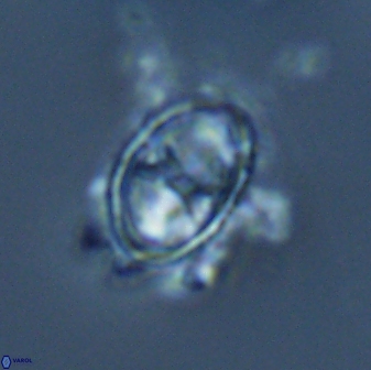 Asynithistostoichos coxalliae 17075