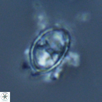 Asynithistostoichos coxalliae 17075