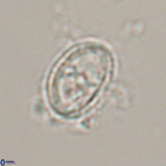 Asynithistostoichos coxalliae 17076