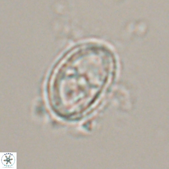 Asynithistostoichos coxalliae 17076