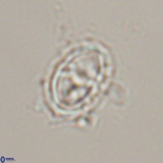 Asynithistostoichos coxalliae 17077