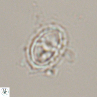 Asynithistostoichos coxalliae 17077