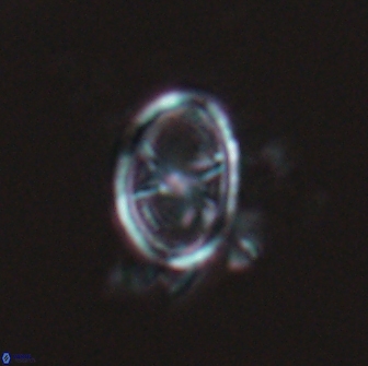 Asynithistostoichos coxalliae 17081