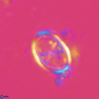 Asynithistostoichos coxalliae 17084