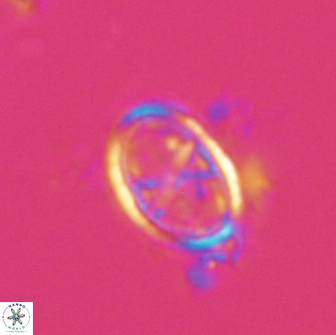 Asynithistostoichos coxalliae 17084