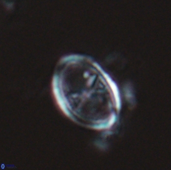Asynithistostoichos coxalliae 17085