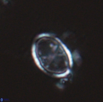Asynithistostoichos coxalliae 17087