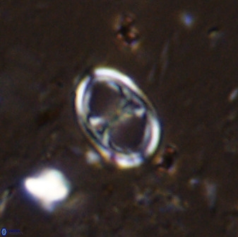 Asynithistostoichos coxalliae 36160