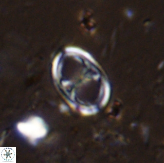 Asynithistostoichos coxalliae 36160