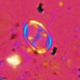 Asynithistostoichos coxalliae 36161
