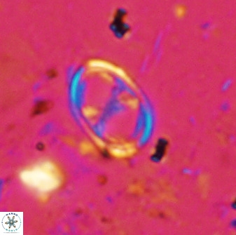 Asynithistostoichos coxalliae 36161