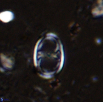 Asynithistostoichos coxalliae 36162