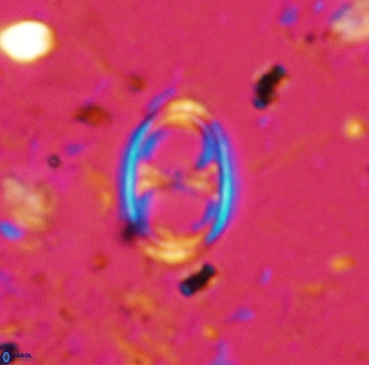 Asynithistostoichos coxalliae 36163