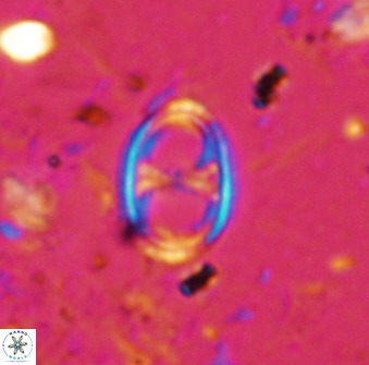 Asynithistostoichos coxalliae 36163